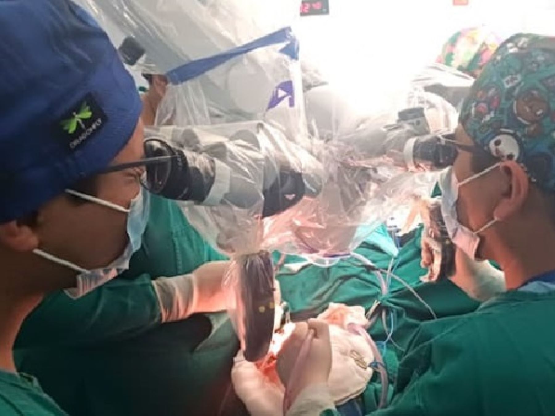 Médicos del IREN Centro salvan vida a paciente tras extirparle un tumor cerebral gigante