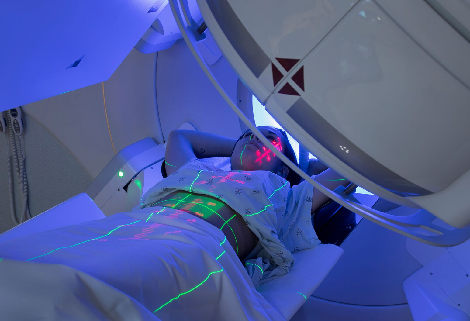 La terapia de campos eléctricos mejora el tratamiento de pacientes con cáncer de páncreas