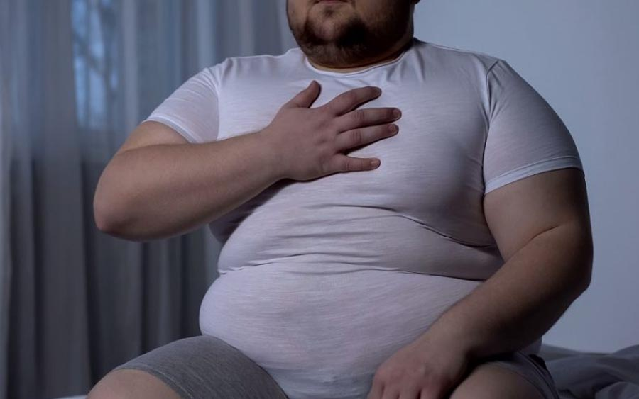 Inesperada relación entre obesidad y menor riesgo de demencia
