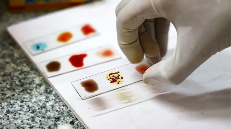 «Sangre dorada»: por qué los científicos están intentando cultivar la sangre más rara del mundo en un laboratorio