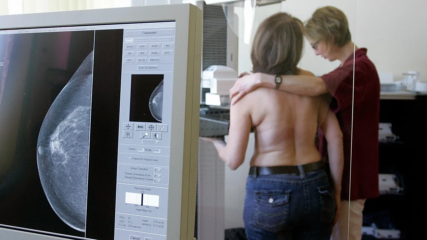 La IA podría ayudar a la detección precoz del cáncer de mama agresivo